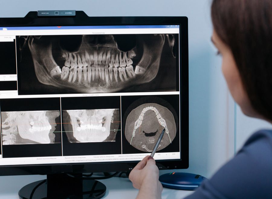 Röntgen vizsgálatok - Pannonia Medical - Sopron